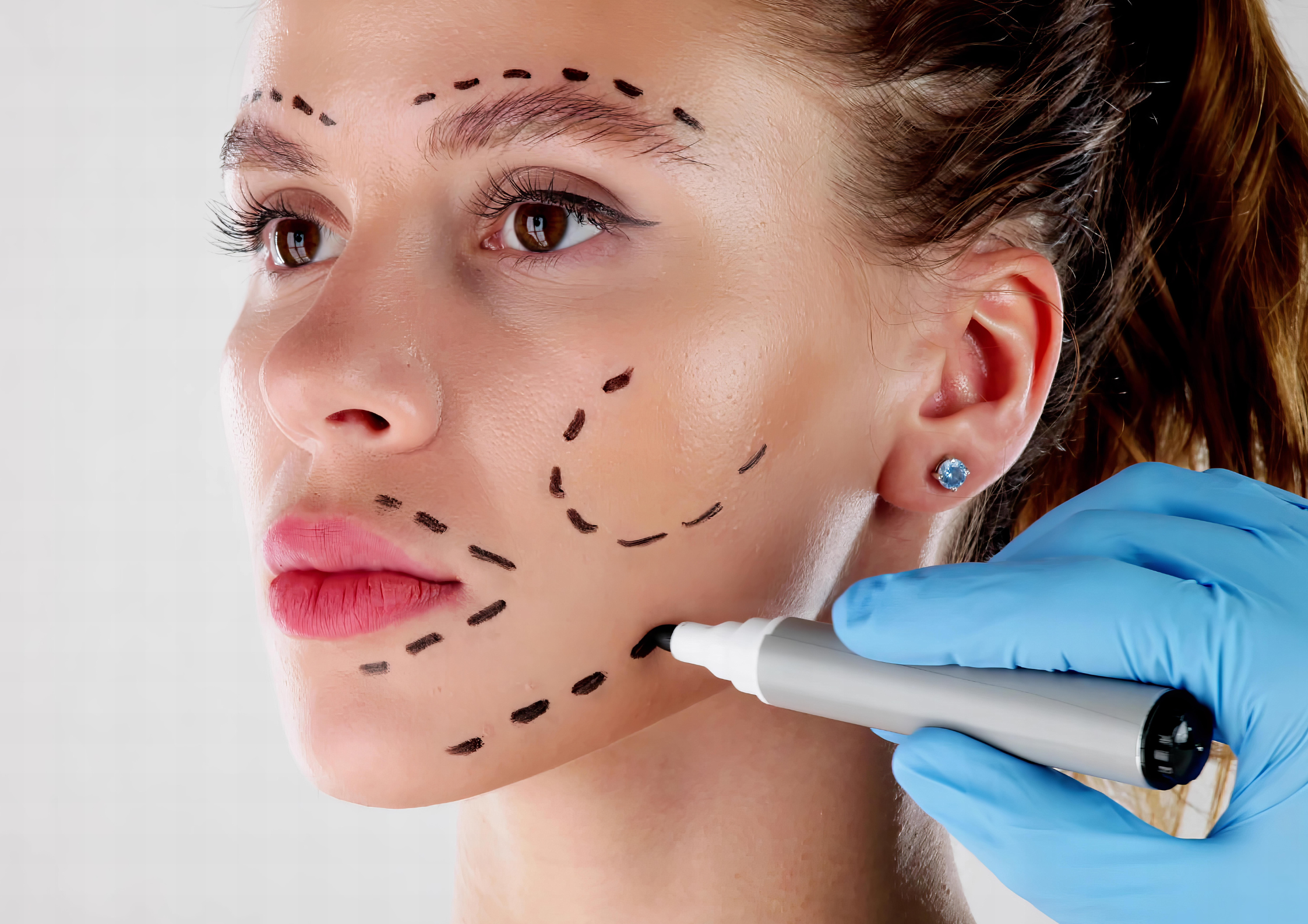 Lifting Facial